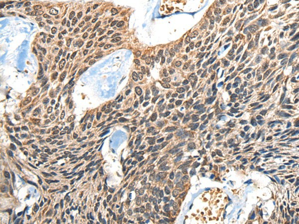 BOLA1 Polyclonal Antibody (E-AB-52476)