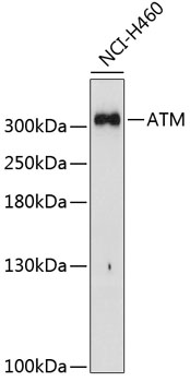 ATM Polyclonal Antibody (E-AB-62008)