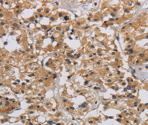 INPPL1 Polyclonal Antibody (E-AB-16523)