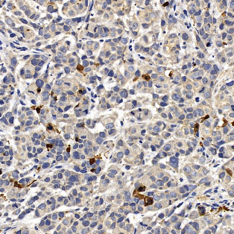 CASP3 Polyclonal Antibody (E-AB-70388)