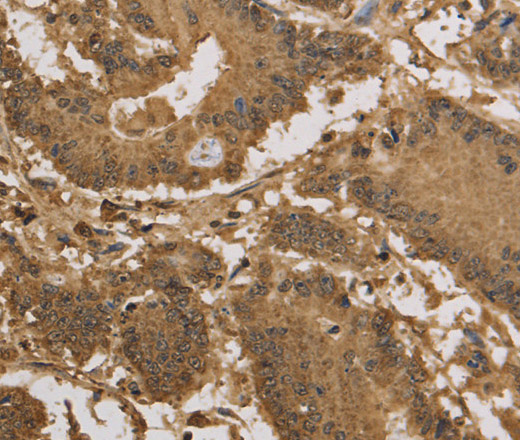 KDM5B Polyclonal Antibody (E-AB-13360)