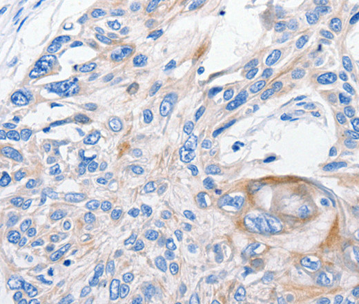 FANCF Polyclonal Antibody (E-AB-10319)