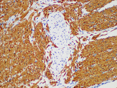 Actin pan Monoclonal Antibody (ELAB6143-M)