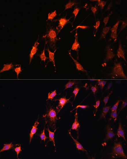 PRR5 Polyclonal Antibody (E-AB-66447)