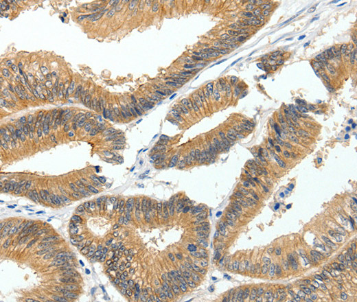 MDK Polyclonal Antibody (E-AB-10458)