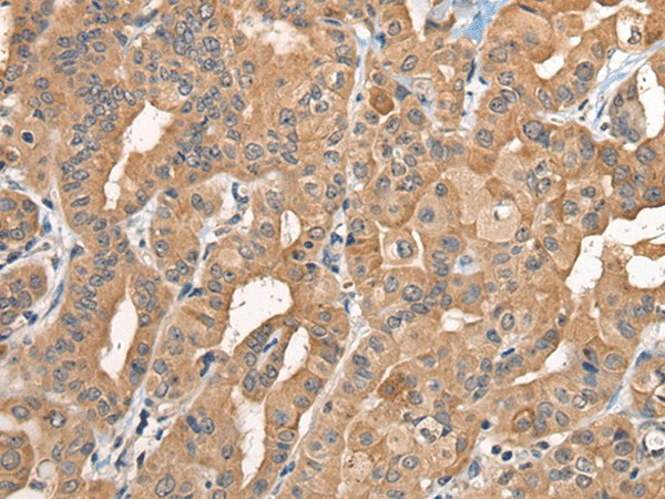 BCAN Polyclonal Antibody (E-AB-18546)
