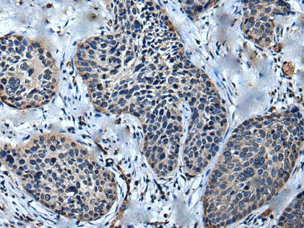 ULK4 Polyclonal Antibody (E-AB-52439)