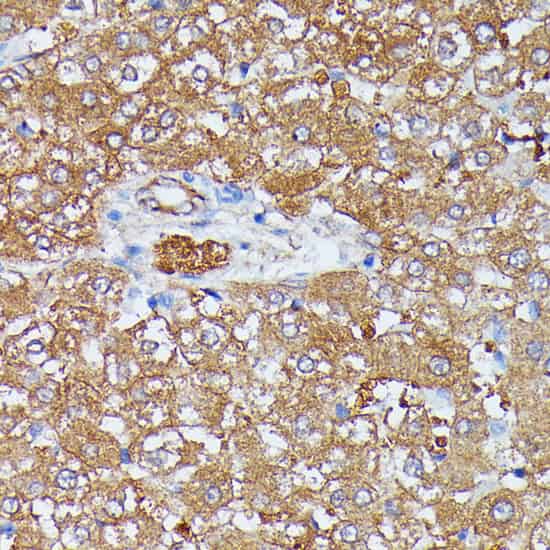 HDLBP Polyclonal Antibody (E-AB-65527)