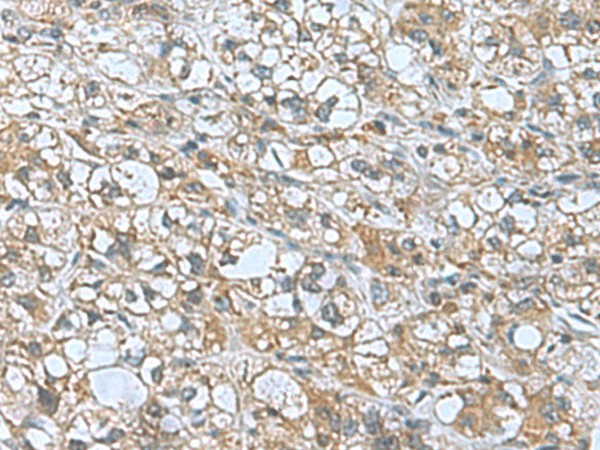 KANSL1L Polyclonal Antibody (E-AB-53010)