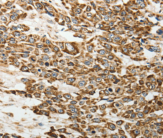 E-Selectin Polyclonal Antibody (E-AB-14325)