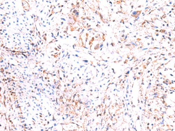 PHKG2 Polyclonal Antibody (E-AB-19024)