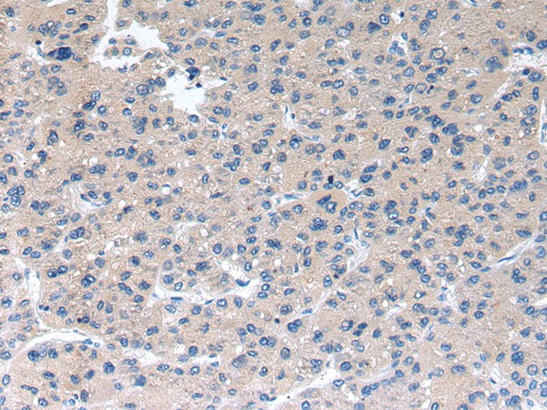 RAB2A Polyclonal Antibody (E-AB-17525)