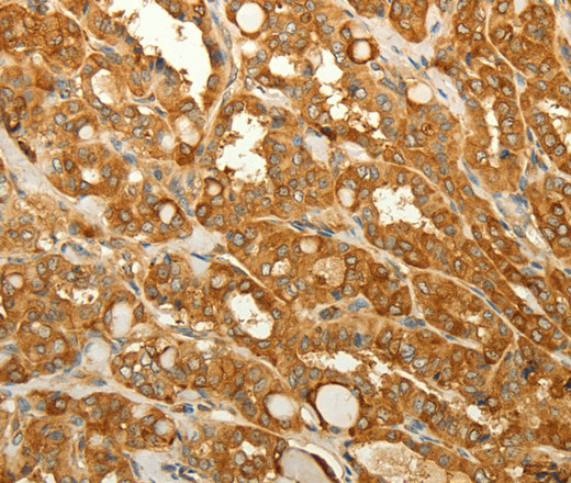 RAB35 Polyclonal Antibody (E-AB-12236)