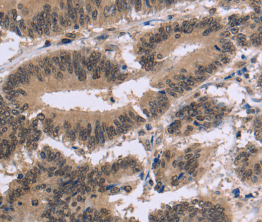 FAM107A Polyclonal Antibody (E-AB-15012)