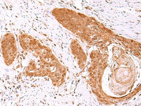FDPS Polyclonal Antibody (E-AB-19027)