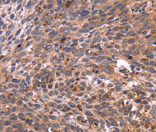 CRK Polyclonal Antibody (E-AB-11105)