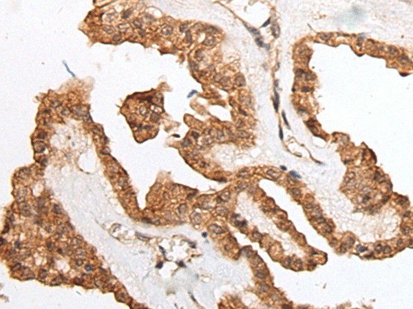 HOXB9 Polyclonal Antibody (E-AB-53468)