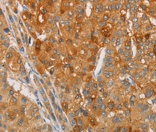 ARSG Polyclonal Antibody (E-AB-14632)