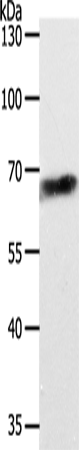 ABCD4 Polyclonal Antibody (E-AB-12686)