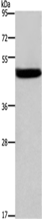 Cathepsin E Polyclonal Antibody (E-AB-13974)