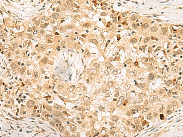 EXOSC4 Polyclonal Antibody (E-AB-53108)