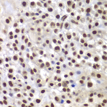 SMARCB1 Polyclonal Antibody (E-AB-61106)
