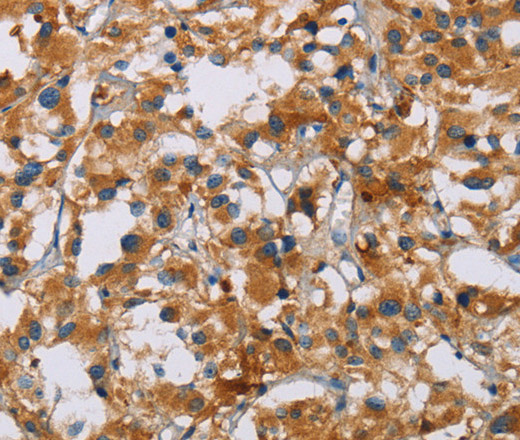 NRN1 Polyclonal Antibody (E-AB-10484)