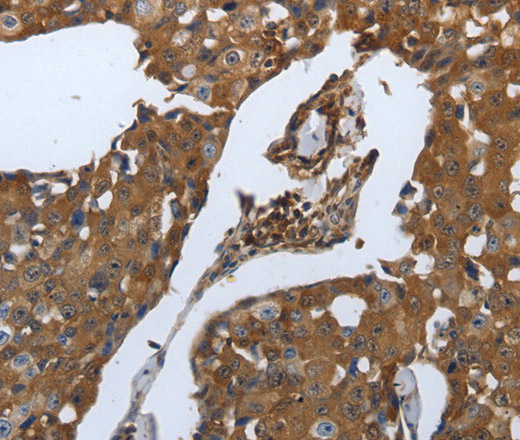 SLC34A2 Polyclonal Antibody (E-AB-12644)