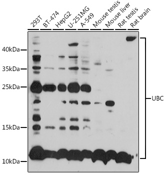 UBC Polyclonal Antibody (E-AB-62252)