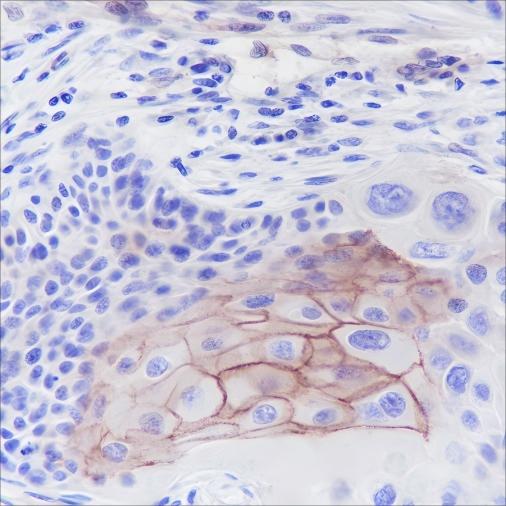 Recombinant Thrombomodulin Monoclonal Antibody (AN301673L)