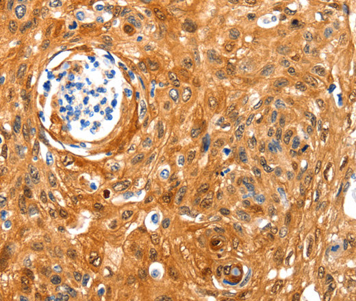 NCOR1 Polyclonal Antibody (E-AB-15800)