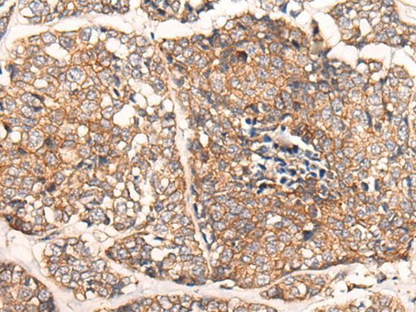 CACNA2D2 Polyclonal Antibody (E-AB-17757)