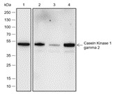 Recombinant Casein Kinase 1 gamma 2 Monoclonal Antibody (AN301832L)