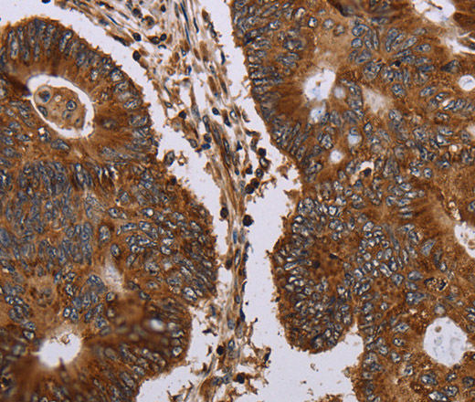 MAGEC2 Polyclonal Antibody (E-AB-13397)