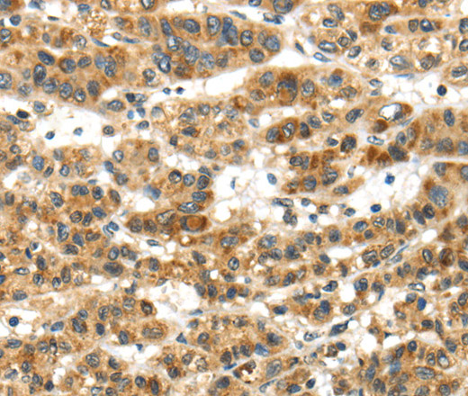 PAPPA Polyclonal Antibody (E-AB-13489)