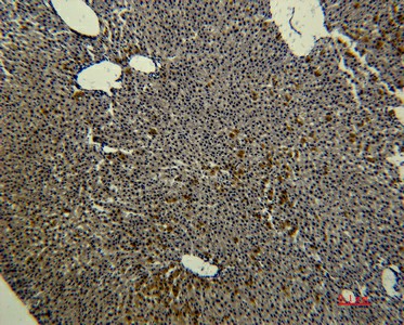 Transferrin Monoclonal Antibody (E-AB-22180)