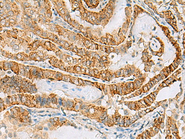 FARP2 Polyclonal Antibody (E-AB-19082)