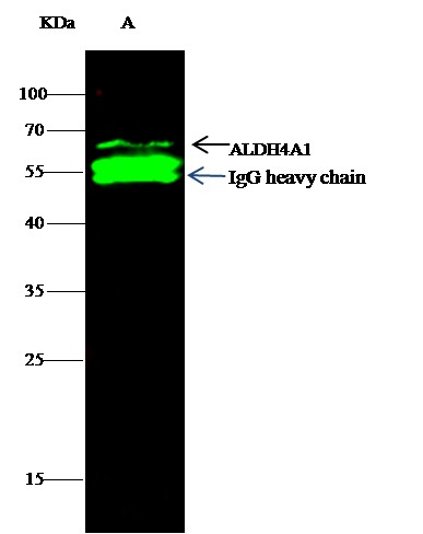 Recombinant ALDH4A1 Monoclonal Antibody (AN300262P)