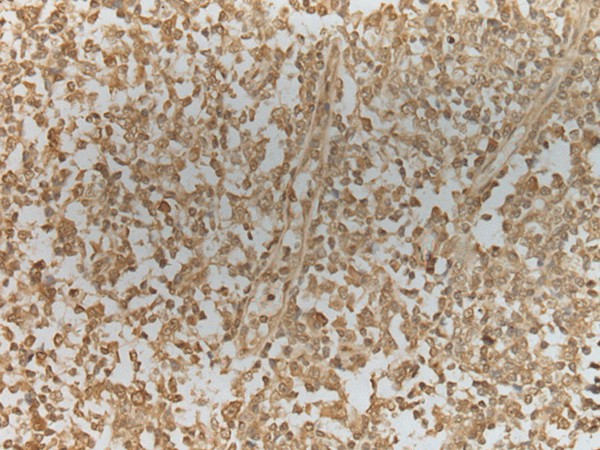 ZNF8 Polyclonal Antibody (E-AB-52395)