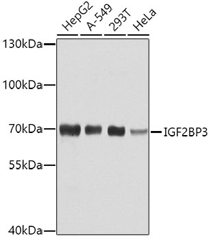 IGF2BP3 Polyclonal Antibody (E-AB-62356)