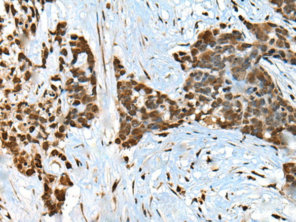CCDC12 Polyclonal Antibody (E-AB-18590)