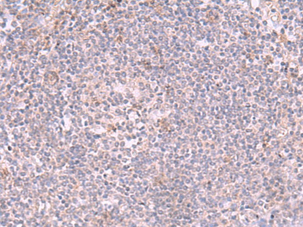 INPP5K Polyclonal Antibody (E-AB-19044)