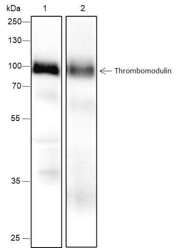 Recombinant Thrombomodulin Monoclonal Antibody (AN301740L)
