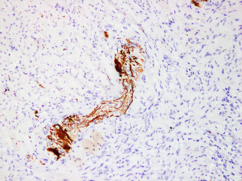 NF Monoclonal Antibody (ELAB6204-M)