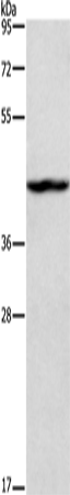 TBX20 Polyclonal Antibody (E-AB-10325)