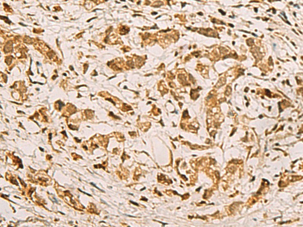 ZMAT4 Polyclonal Antibody (E-AB-52816)