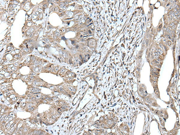 RAD54B Polyclonal Antibody (E-AB-53323)