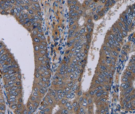 NECTIN4 Polyclonal Antibody (E-AB-15250)