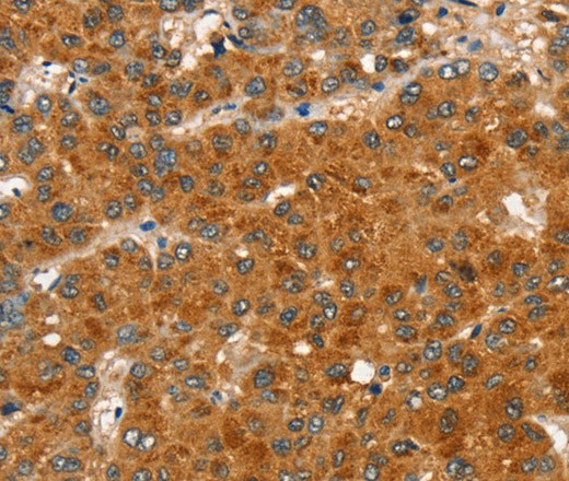 RASA3 Polyclonal Antibody (E-AB-16753)