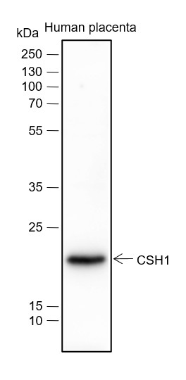 Recombinant Placental Lactogen Monoclonal Antibody (AN301560L)
